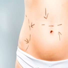 Fat Burning Injections Better than Liposuction